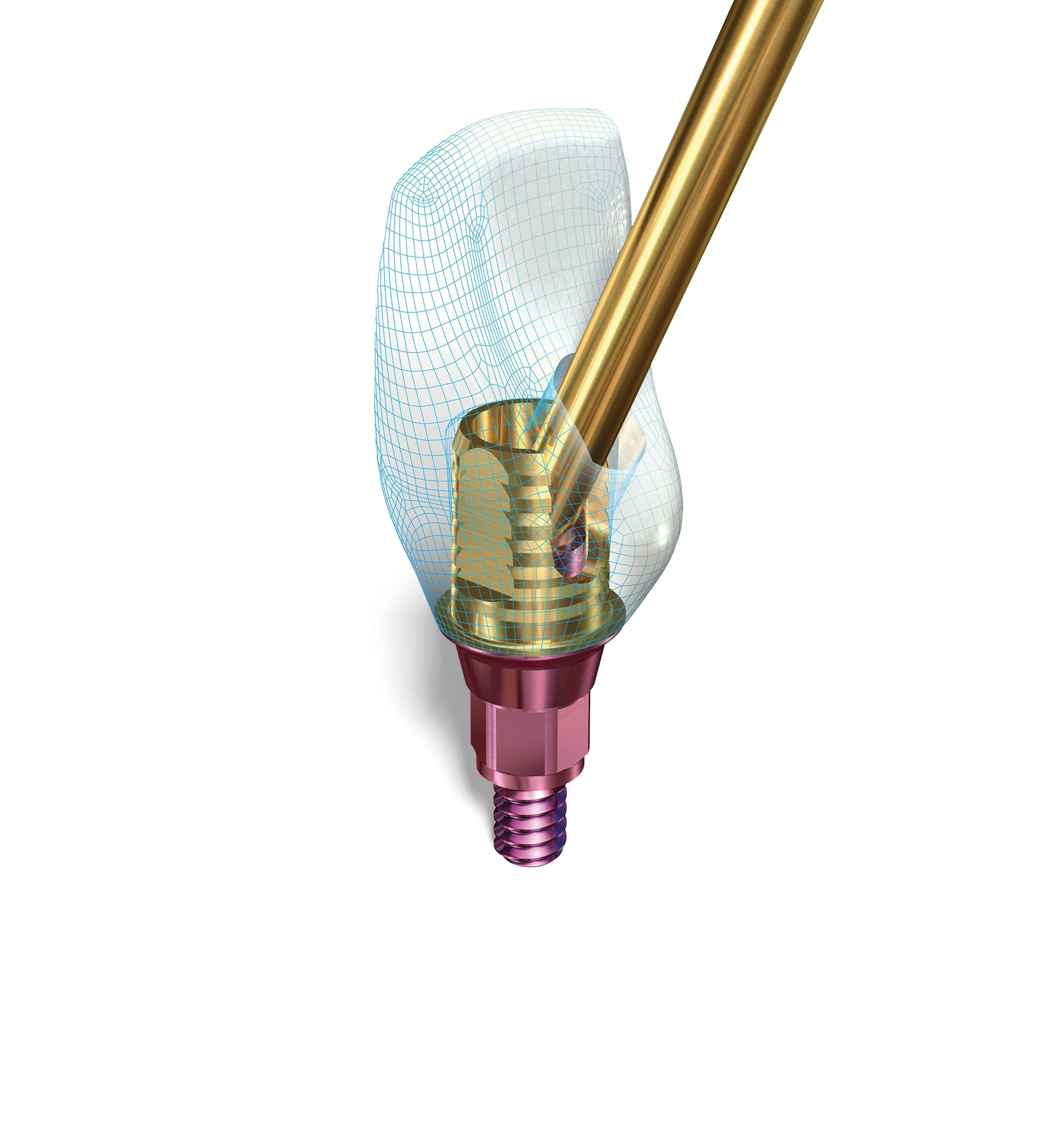 SMARTbase from Implant Direct